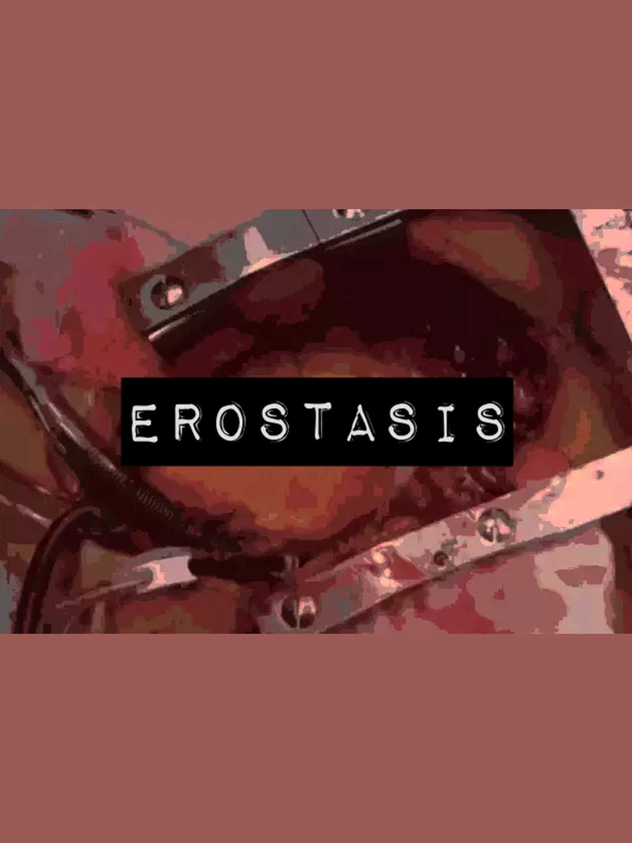 Erostasis cover