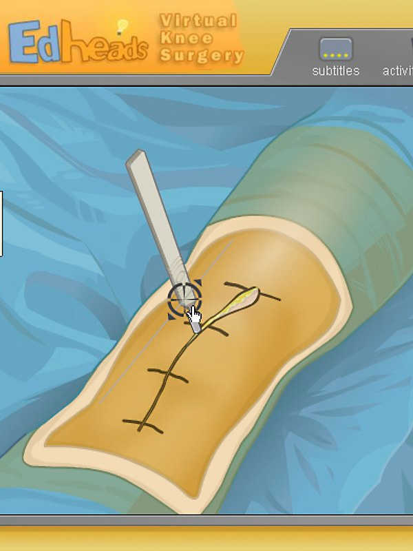 Virtual Knee Surgery cover